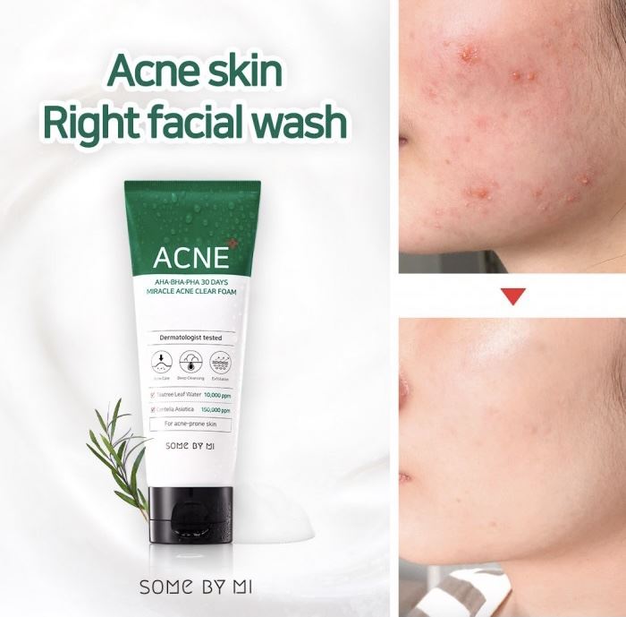 Очищаюча пінка Some By Mi AHA-BHA-PHA 30 Days Miracle Acne Clear Foam 100 ml